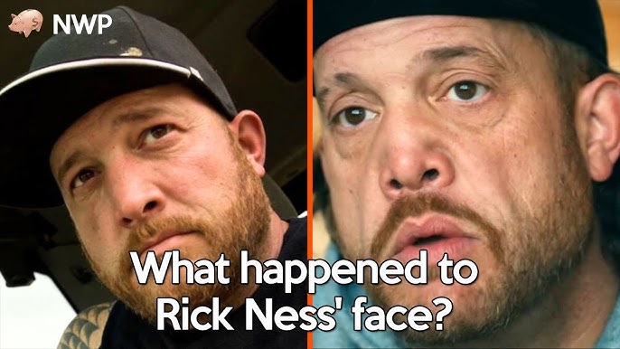What happened to “Gold Rush” star Rick Ness' face?